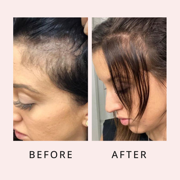 Luxe Hair Growth Serum, Hair Growth Serum, Growth Serum, Hair Serum